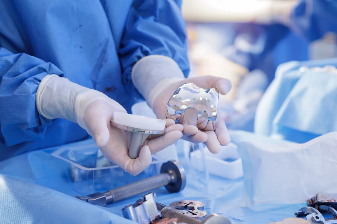 CNC Milling and Machining Powers the Future of Custom Medical Implants